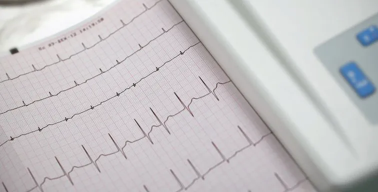 Atrial fibrillation research