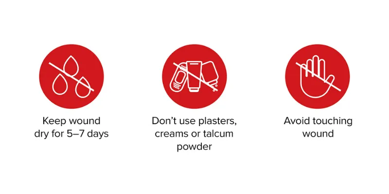 Post‑surgery wound care icons showing instructions to keep incision dry for 5–7 days, avoid plasters, creams or talcum powder, and not touch the wound.