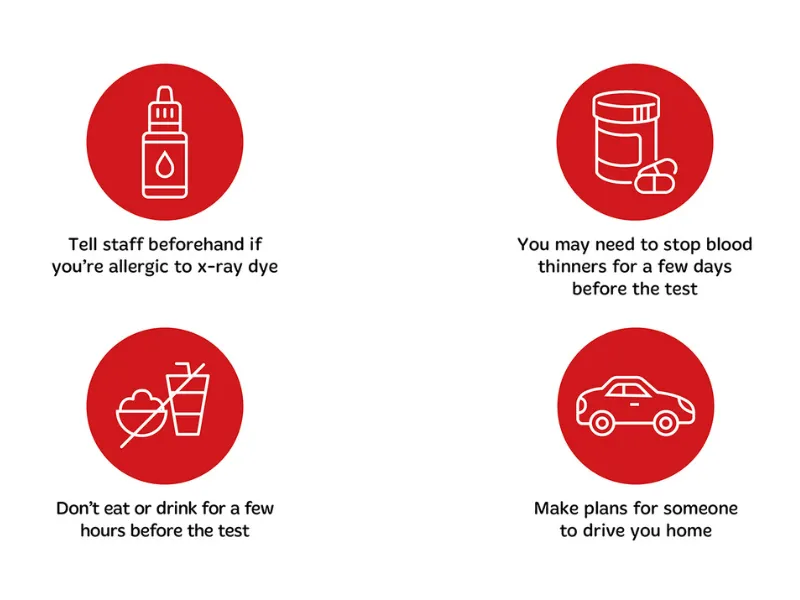Infographic showing how to prepare for a coronary angiogram test, including telling staff about x-ray dye allergies, managing blood thinners, fasting before the test, and arranging someone to drive you home.