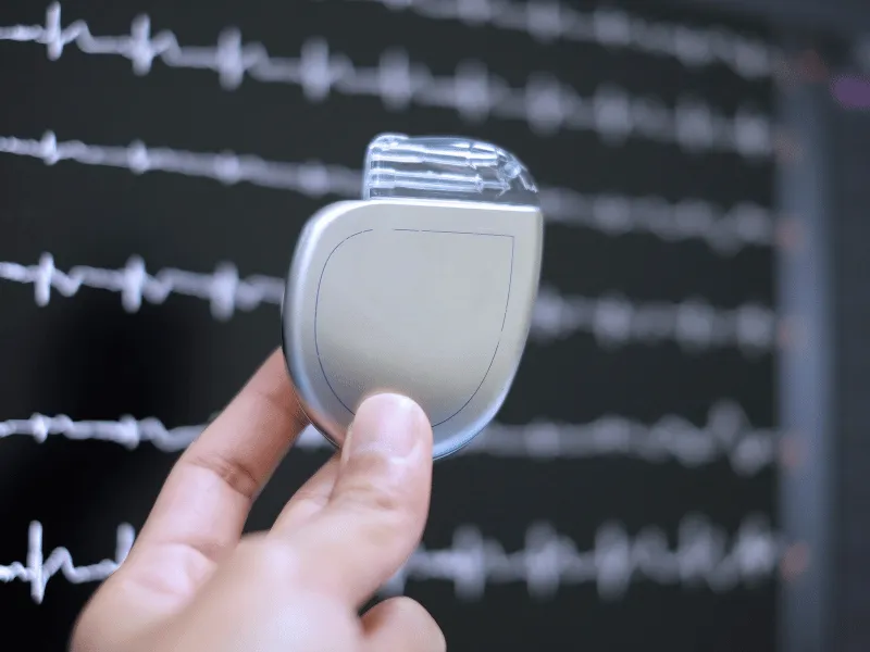 Close-up of implantable cardioverter defibrillator (ICD) device held in front of heart rhythm ECG monitor screen.