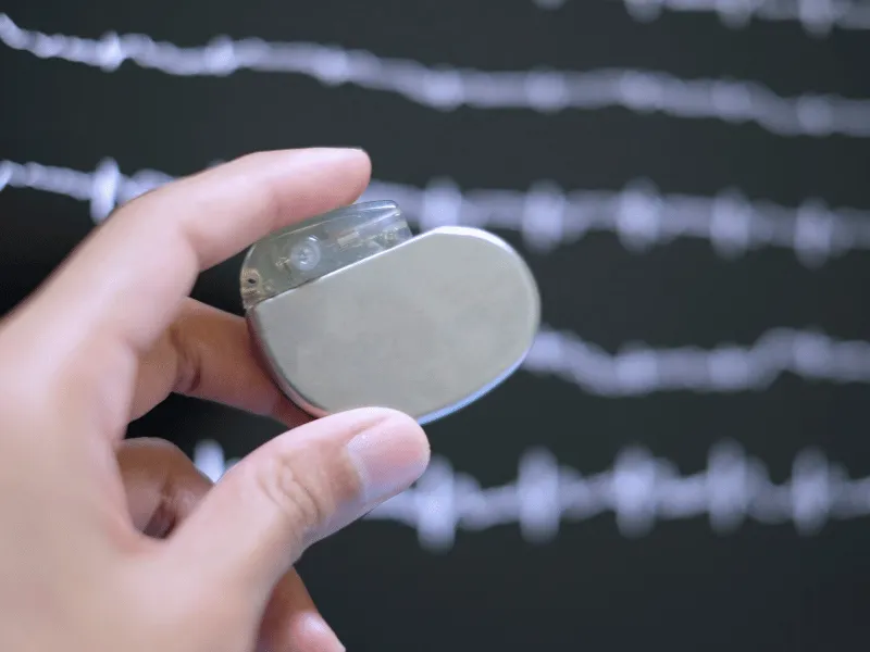 Hand holding a modern cardiac pacemaker device in front of a heart rate ECG monitor background.