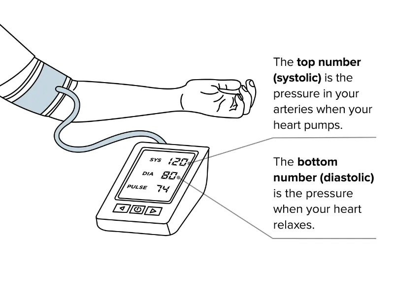 arm with a blood pressure cuff wrapped around the top of it. Blood pressure monitor showing systolic and diastolic blood pressure readings.