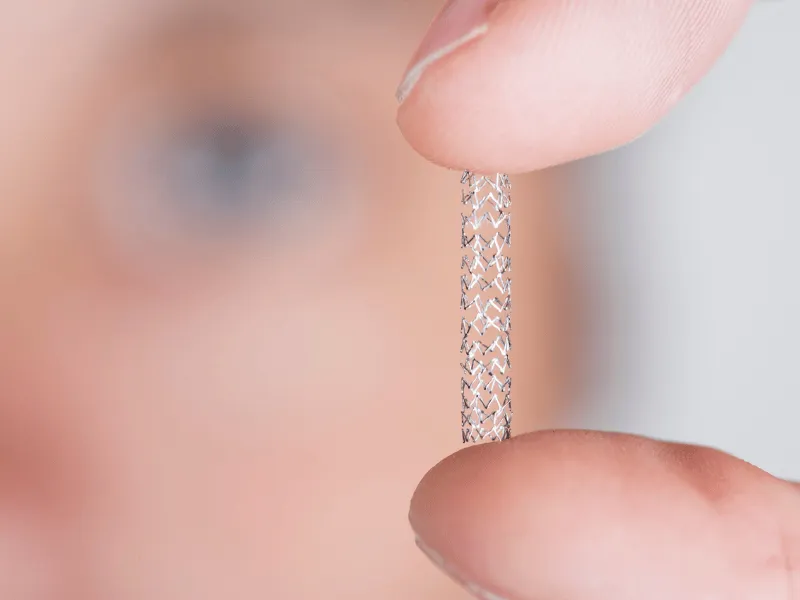 Close‑up of a hand holding a metallic coronary stent next to a catheter, demonstrating the device used in angioplasty to keep narrowed heart arteries open.