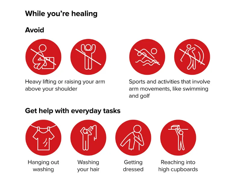 Post‑pacemaker surgery recovery infographic showing activities to avoid, like heavy lifting and sports, and everyday tasks to get help with, such as washing hair, getting dressed, and reaching high cupboards.